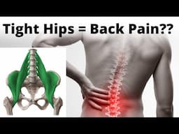 Tight Hips - This Might be Causing Your Low Back Pain