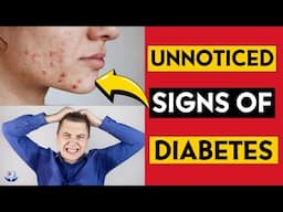 11 Unnoticed Signs of Diabetes You Need to Know