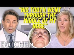 Laura's Dog RIPPED A Giant Hole In Her Nose | Botched | E!