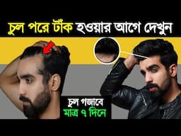 চুল পড়া বন্ধ ও নতুন চুল গজানোর উপায় | How To Grow Hair and Stop Hair Fall | Success Never End