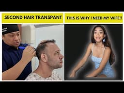 Second Hair Transplant Philippines? | Why I Did It Again?