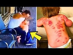 Mom Finds Bite Marks on Daughter, Freezes After Seeing Boyfriend on Hidden Camera Footage