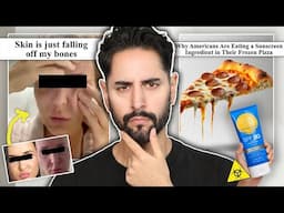 Problematic D'alba PR Trip - Toxic Sunscreen Pizza & Filler Dissolving Disasters - Ugly Beauty News