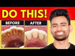 How to Remove Dental Plaque & Prevent Cavities?