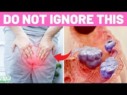 10 Critical Colon Cancer Symptoms You Should Never Ignore