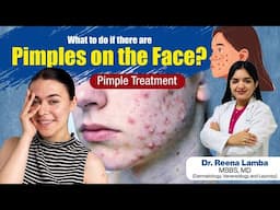 What to do if there are Pimples on the Face? Pimple Treatment | Acne | Rungta Hospital, Jaipur