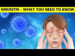 Sinusitis - Causes, Pathogenesis, Signs & Symptoms, Diagnosis, And Treatment