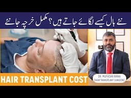 Hair Transplant In Pakistan - Naye Baal Kaise Lagaye Jaate Hain - Hair Transplant Treatment & Cost