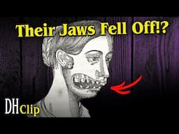 The TERRIFYING & IRREVERSIBLE Effects of White Phosphorous | Dark History: CLIP