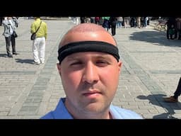 I got a Hair Transplant In Turkey.