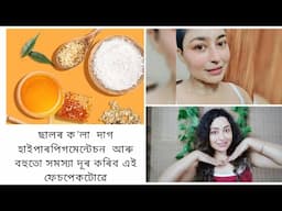 Face Mask For Hyperpigmentation | Assamese Skin Care Video