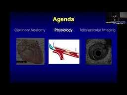 Annapoorna S  Kini, MD   Coronary Anatomy  Physiology and Imaging