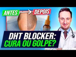 DHT BLOCKER é golpe? Para a CALVÍCIE? Funciona?