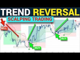 99% Accurate Price Action Strategies Price Action Scalping Trading Like a Pro | Forex Strategies