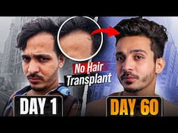 How I Reversed My Hair Loss? Kaash yeh pehele pata hota 😔