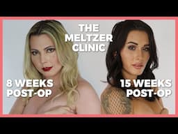 Trans Women React to Each Other's Boobs (Post-Op) The Meltzer Clinic | Casey Blake