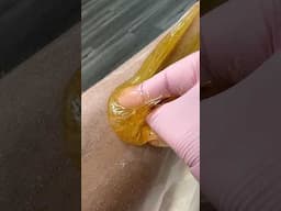 SUGARING | WAXING #sugarwax #waxing #hairremoval #esthetician #legwax