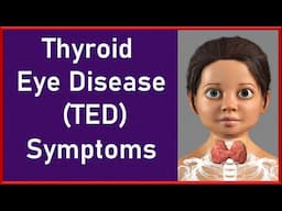 Thyroid Eye Disease TED Symptoms