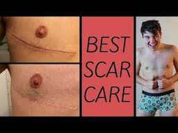 How To Make Your Scars Disappear! (Top Surgery - FTM Transgender)