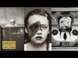 Eerie and Unsettling Medical Devices from the 1800s-1900s | Bizarre Rare Historical Photos