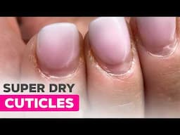 E-file Manicure for Overgrown Cuticles | Encapsulated Glitter French Tips