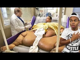 the world's fattest man..