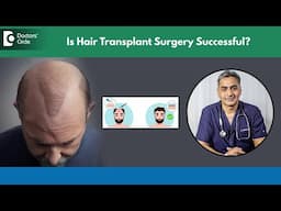 Hair Transplant Success Stories:Tips for Maximizing Results #hairloss -Dr.Srikanth V|Doctors' Circle