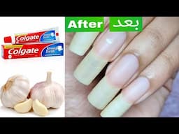 How to GROW YOUR NAILS FAST IN 3 DAYS !!! 100% effective