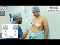 Female To Male Gender Change Surgery In India Delhi Mumbai Bangalore Hyderabad Chandigarh Lucknow