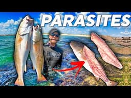 We Are All Eating Parasites!! What You Need to Know Jetty Fishing