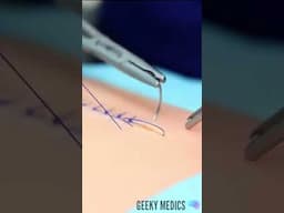 Simple Interrupted Suture in 30 seconds