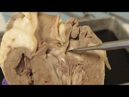 Heart Dissection Internal Anatomy