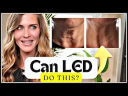 EXPERT Guide to LED: Melasma,  Eye Health, Fat Loss...What LED can and can't do 🤩 with Bev Sanderson