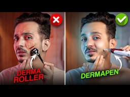 Dermaroller vs Dermapen: Shocking Results on SCARS!😲 My Scars Are Fading!