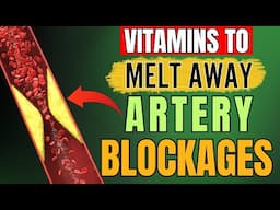 Remove Artery Plaque Naturally: 14 Powerful Vitamins and Supplements! (not what you think)