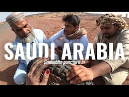 Snakebite puncture on a remote road in Saudi Arabia