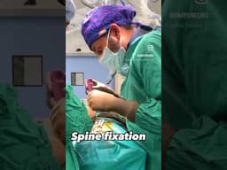 Spine Fixation Surgery! Dr. Arijit Chakraborty #spinecare