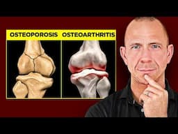 How to Prevent and Treat Osteoporosis vs. Osteoarthritis [full guide]