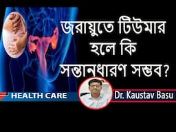 জরায়ুর টিউমারের লক্ষণ ও চিকিৎসা | Uterine fibroid - causes, symptoms, diagnosis & Modern treatment