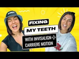 VANITY turned NECESSITY | Starting Invisalign and Carriere to Fix My Teeth