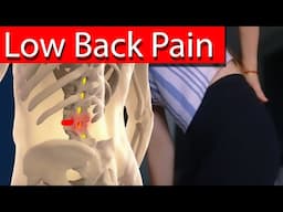 Top  5 Causes of Low Back Pain