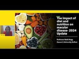 The impact of diet and nutrition on macular disease with Professor Ruth Hogg.