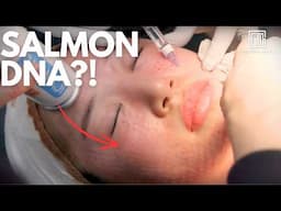 I Tried Salmon DNA 2.0! Newer Version Rejuran | NO PAIN??!! | Seoul Guide Medical