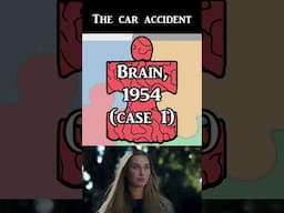 Aphantasia case study (Brain, 1954, case 1) #neuroscience #psychology #casestudy #brain