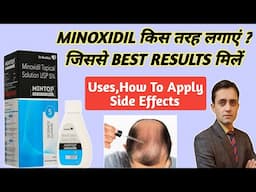 How to use minoxidil for hair regrowth / Minoxidil topical solution usp 5 / Mintop