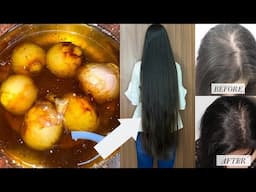 I only Use This Magical Remedy To Grow Double Hair Length in Just 1 Month | Long & Thick Hair