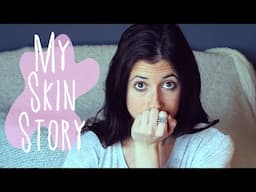 My Skin Story | Acne, Diet, and Skin Care