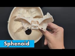 Sphenoid Bone