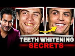 Celebrity TEETH WHITENING Secrets Revealed | Whiten 20 Shades in 1 Week