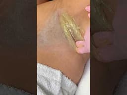 SUGARING | SUGAR WAX #waxing #hairremoval #sugarwaxing #sugarwax